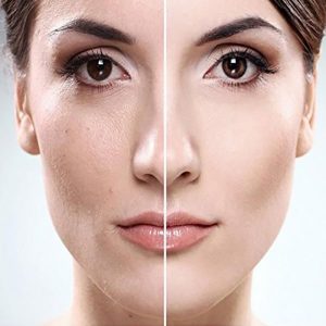 لایه برداری عمیق پوست در خانه