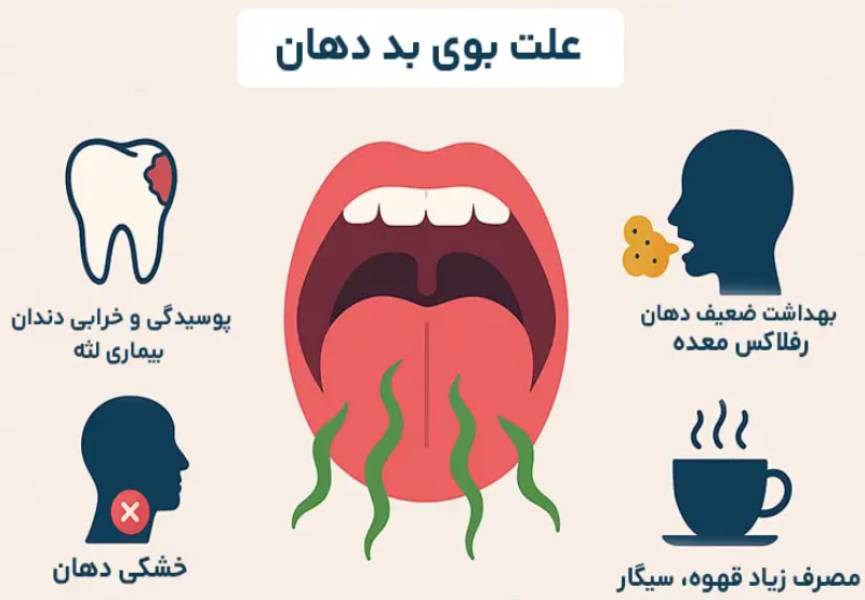 بهترین اسپری خوشبوکننده برای بوی بد دهان